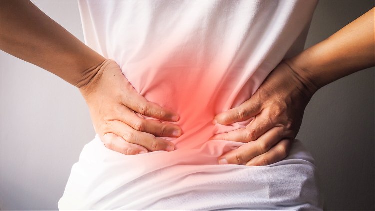 Kako se rešiti bola u leđima (išijas)?