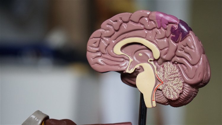 Informacije koje treba da znate o aneurizmi mozga