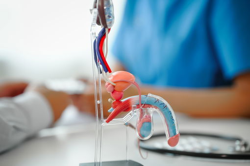Preko 1,000 muškaraca u Srbije premine od raka prostate