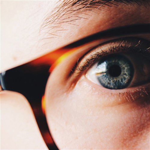 Znate li šta je to astigmatizam?